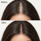 DASI | Korean Scalp Revival Bar
