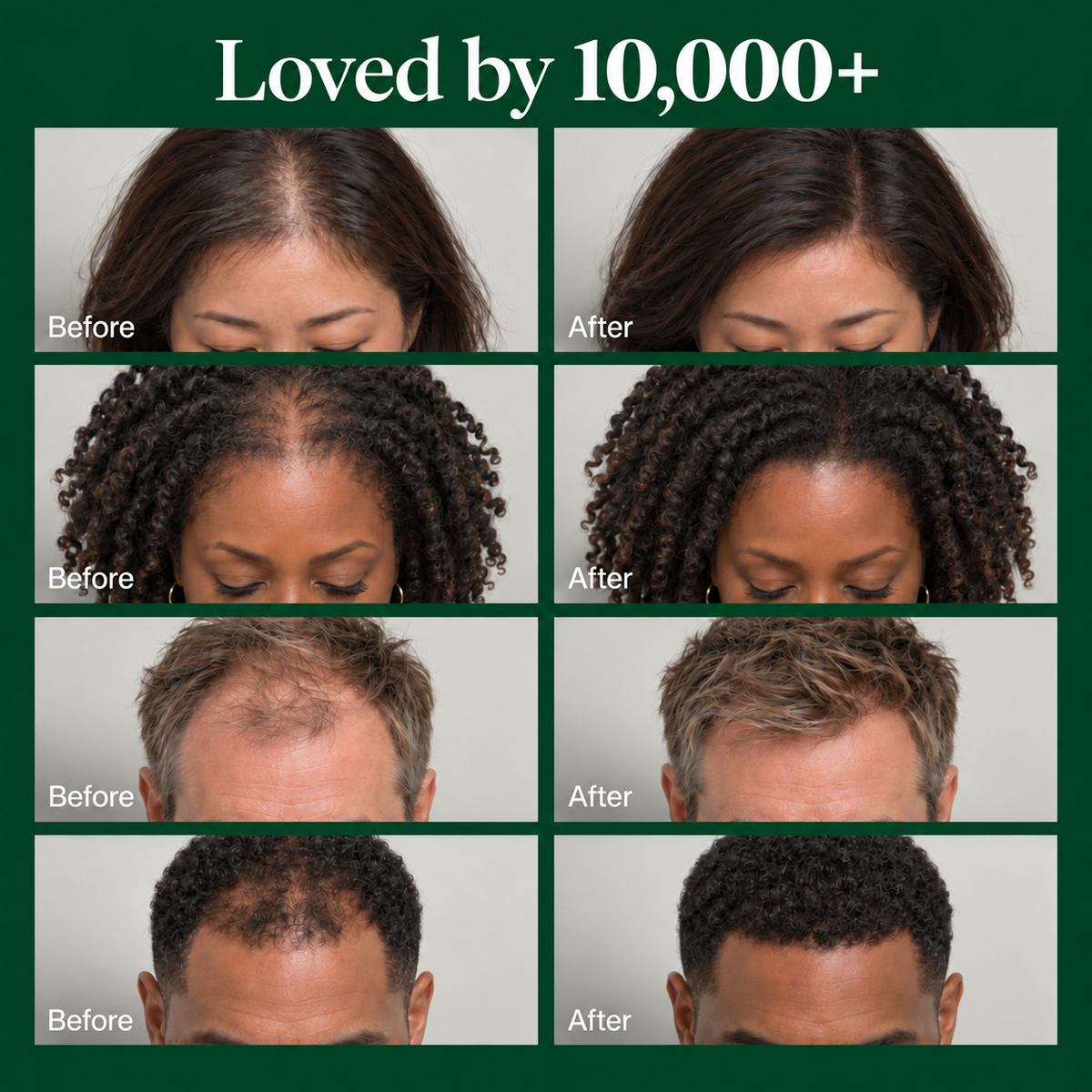 DASI | Korean Scalp Revival Bar